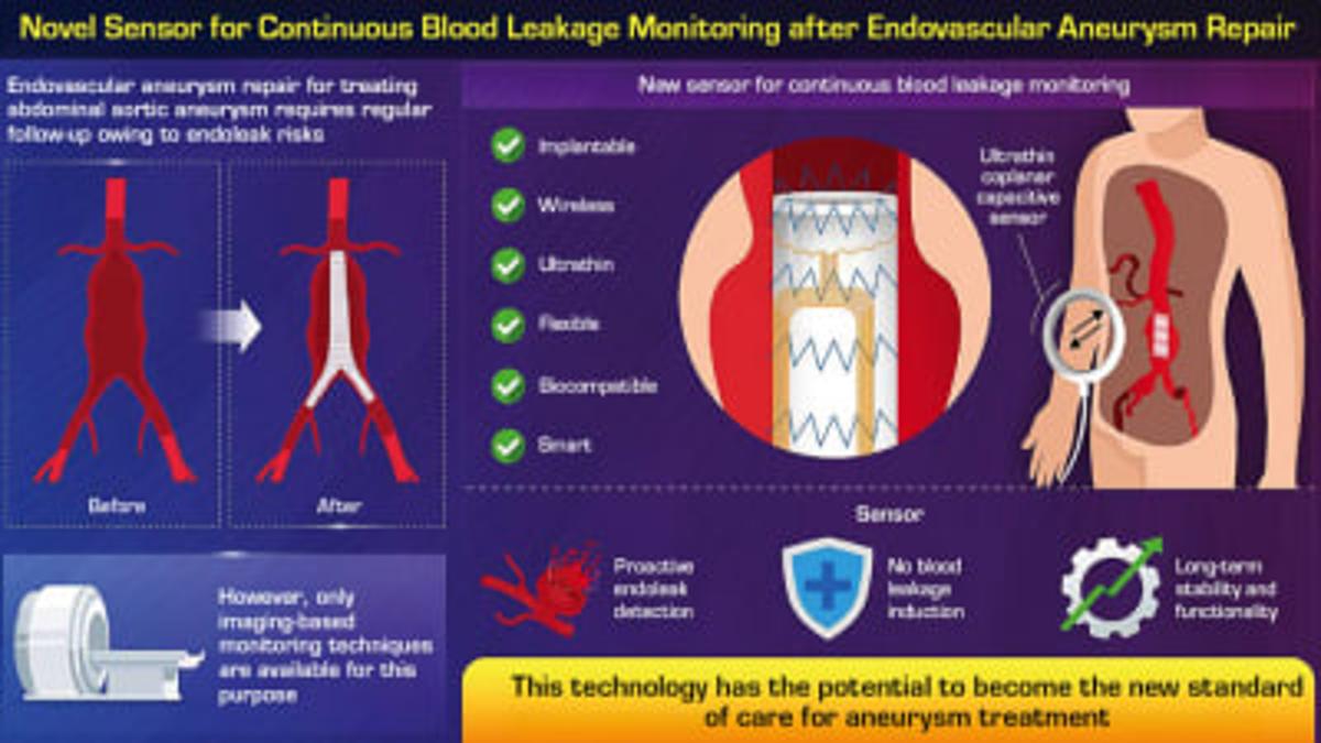 Novel Sensor Offers Continuous Blood Leakage Monitoring