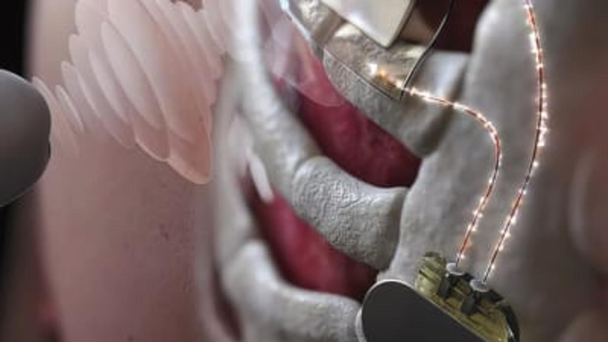 Ultrasound as a New Wireless Power Transfer Technology