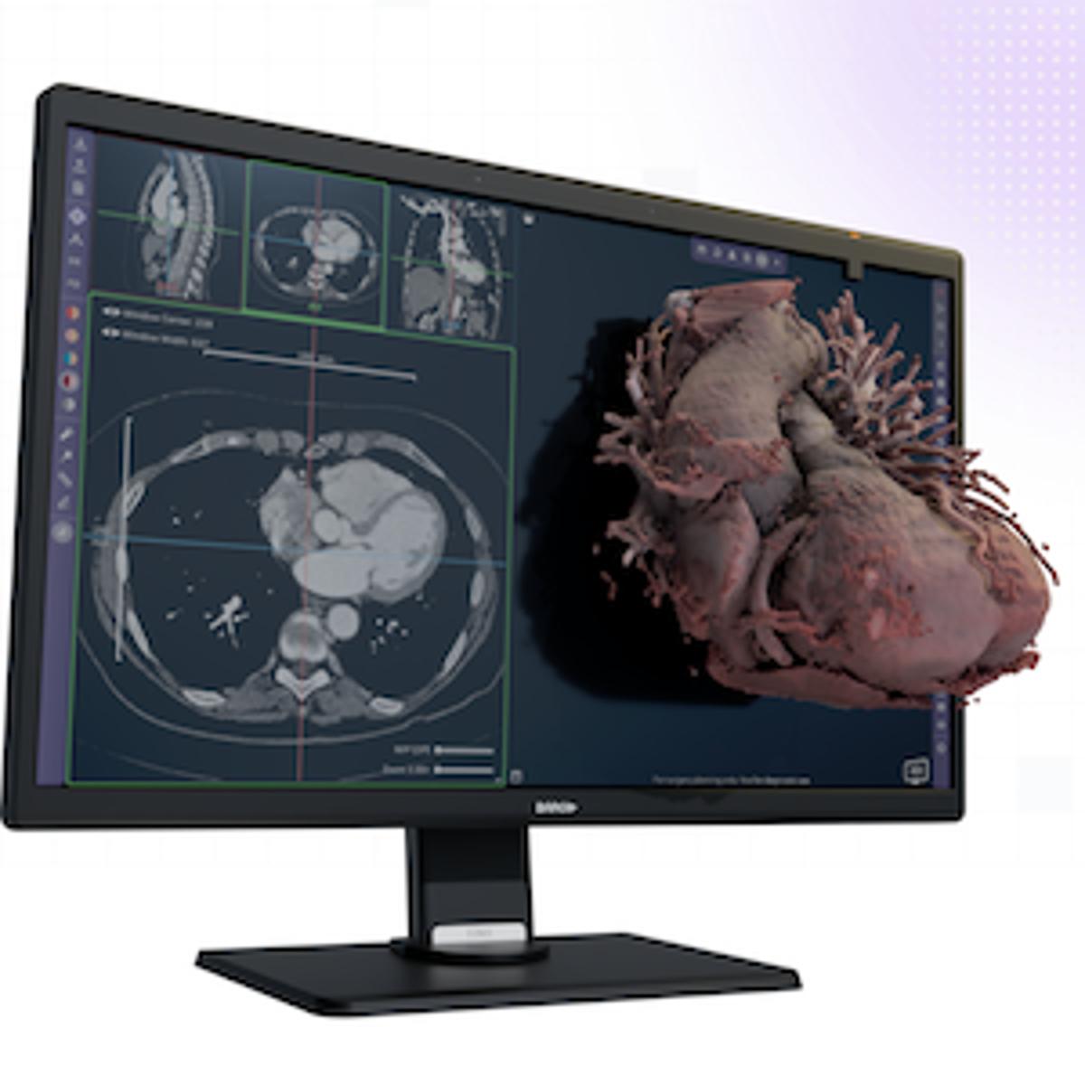 FDA Grants Clearance for Avatar Medical Vision
