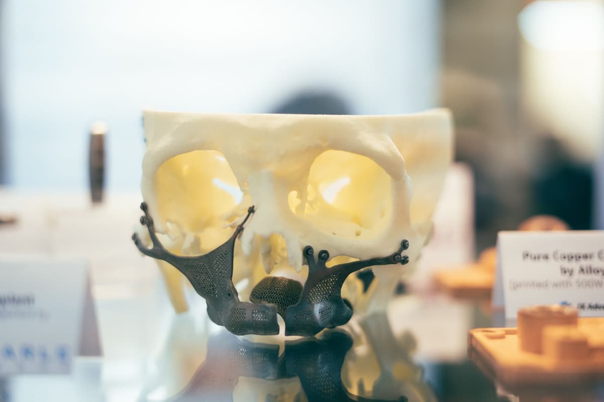 TANIOBIS Enables Patient-Specific Implants With Tantalum and Niobium Alloys