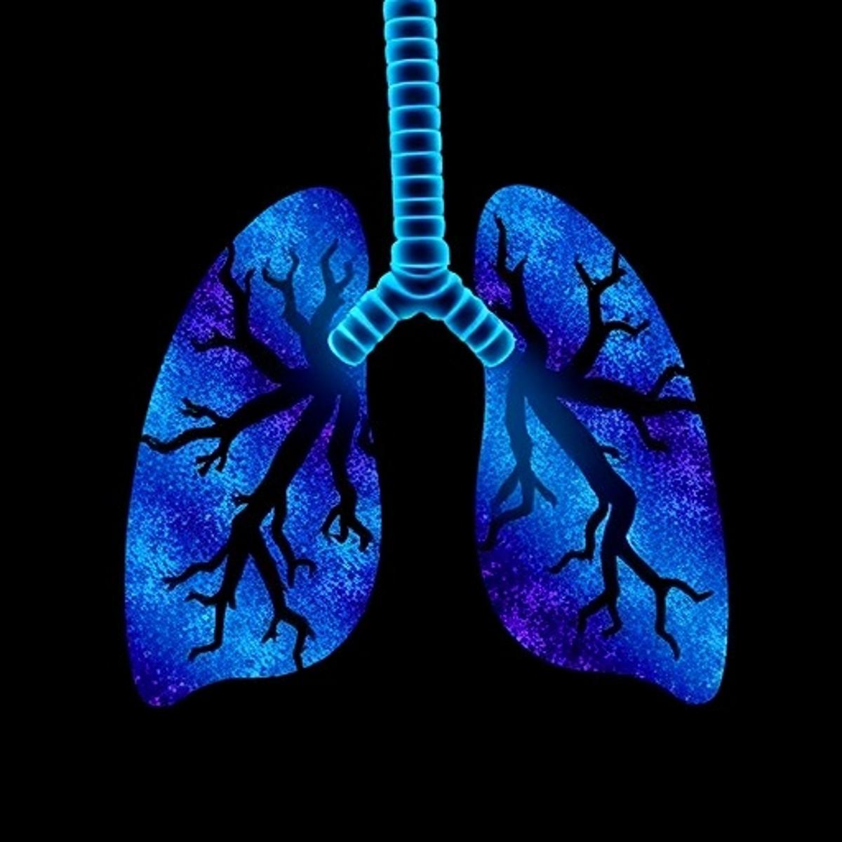 ALDH3A1 Pathway Boosts AHR for Lung Protection