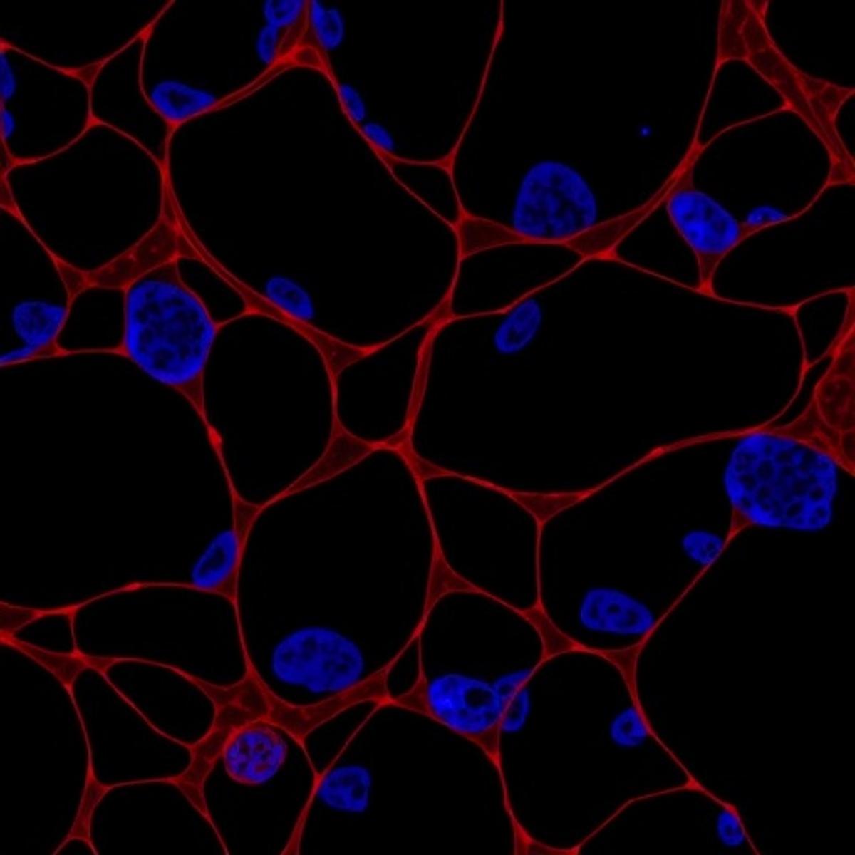 GPR182 Impedes Angiogenesis by Modulating CXCL12-CXCR4 Signaling