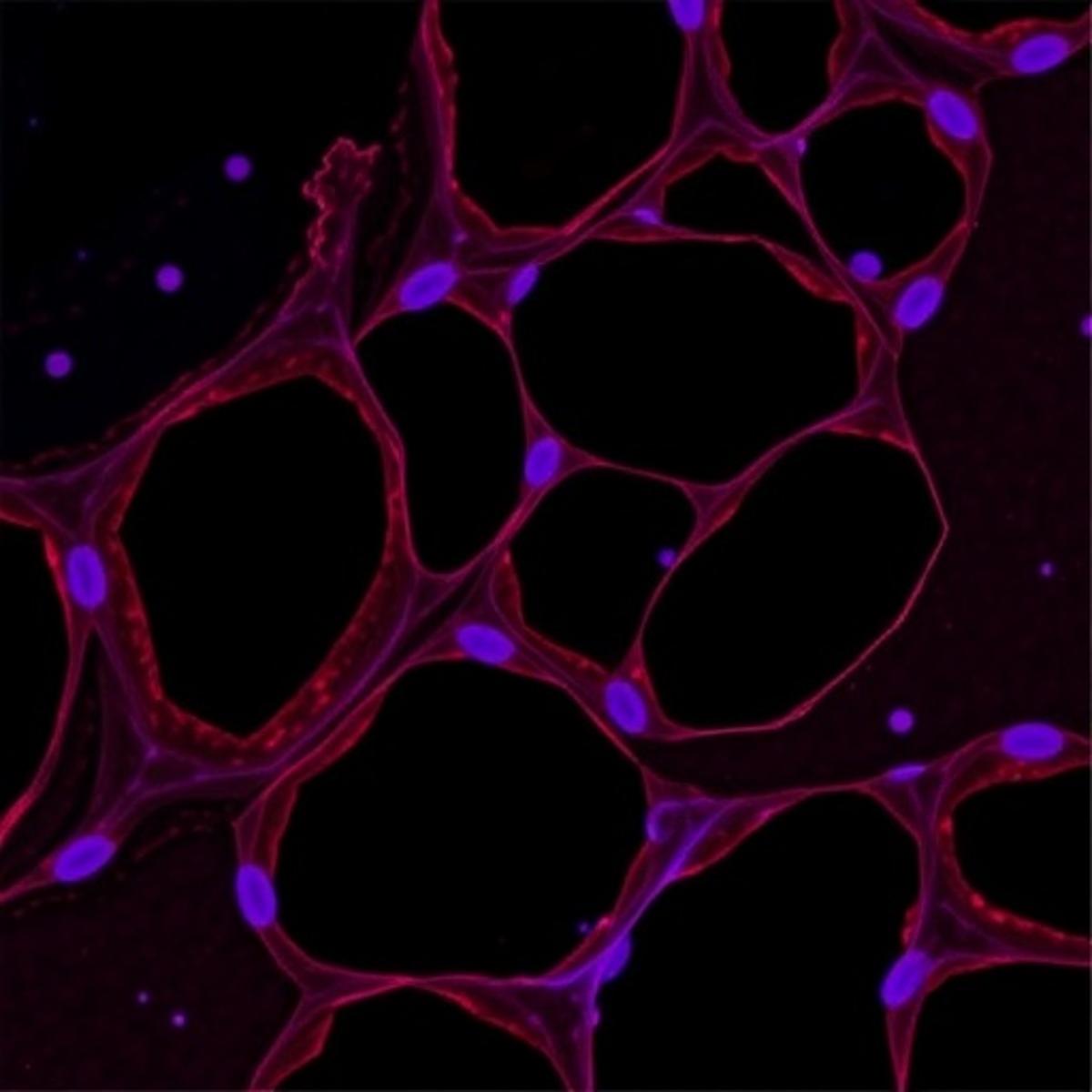 LncRNA PVT1 Influences Endothelial Function in DVT