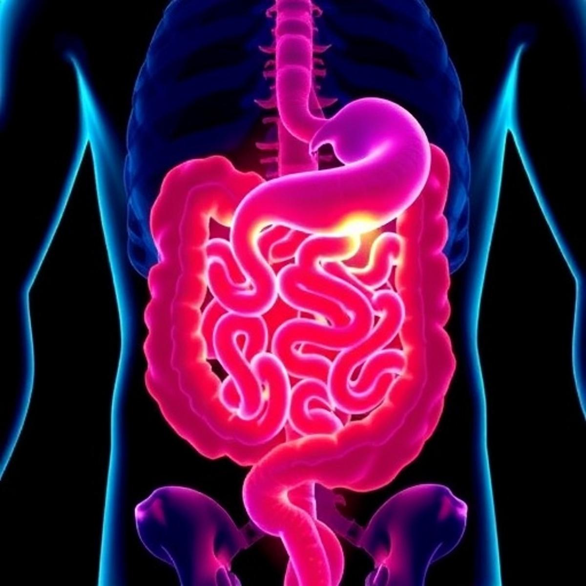 MCM8 Accelerates Colorectal Cancer by Inhibiting Ubiquitination