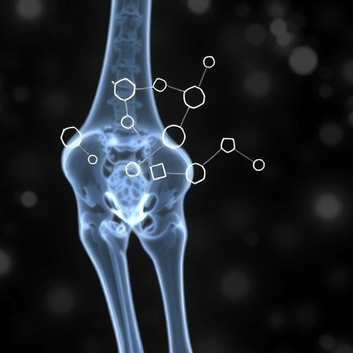 Toxic Impact of Perfluorooctanoic Acid on Bone Cells