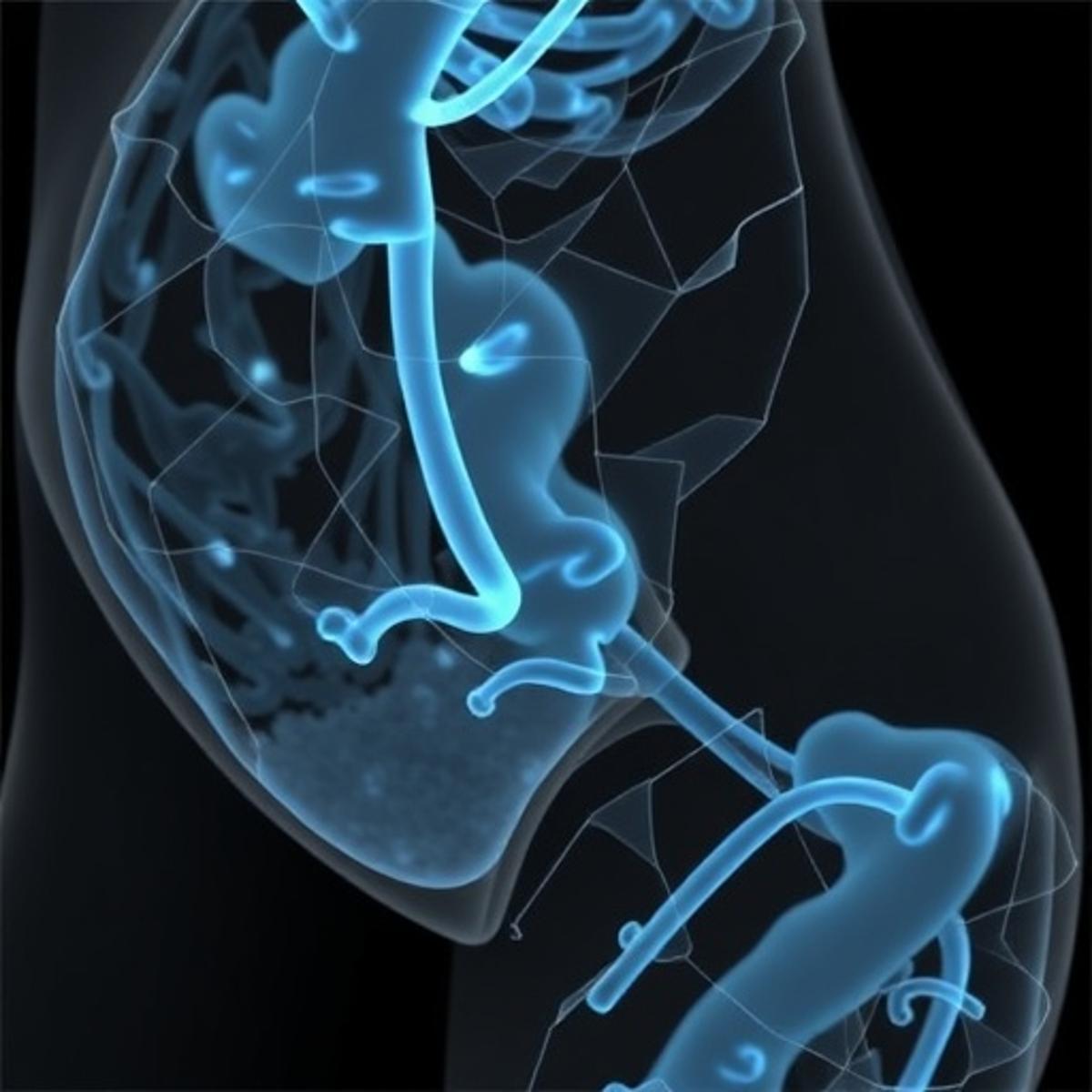 Fibrosis in Uterine Leiomyomas: Impact of Race and Genetics