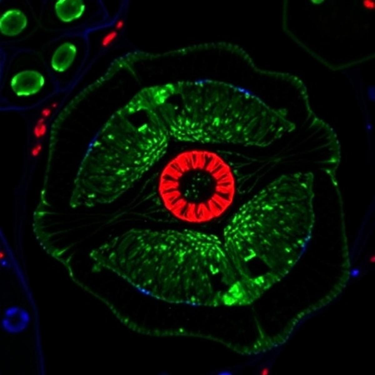 Unlocking Tumor Lymph Node Metastasis with Single-Cell Omics