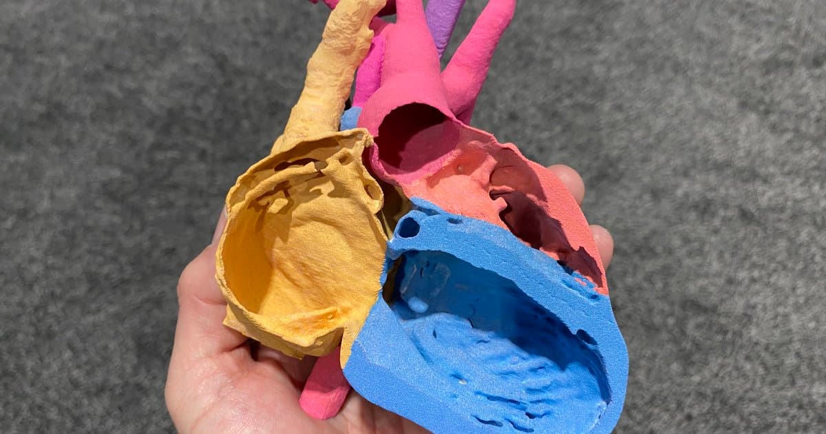 AI Helps Identify Risk in Adults with Congenital Heart Disease