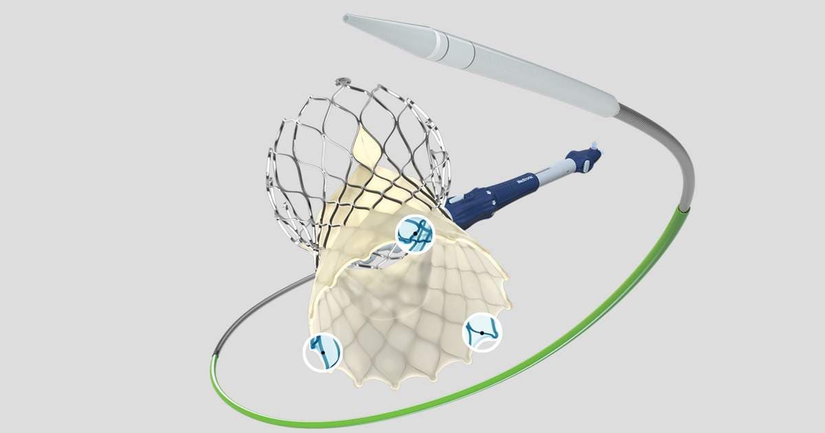 SMART Update: Self-Expanding TAVR Valves Still Linked to Superior Durability After 3 Years
