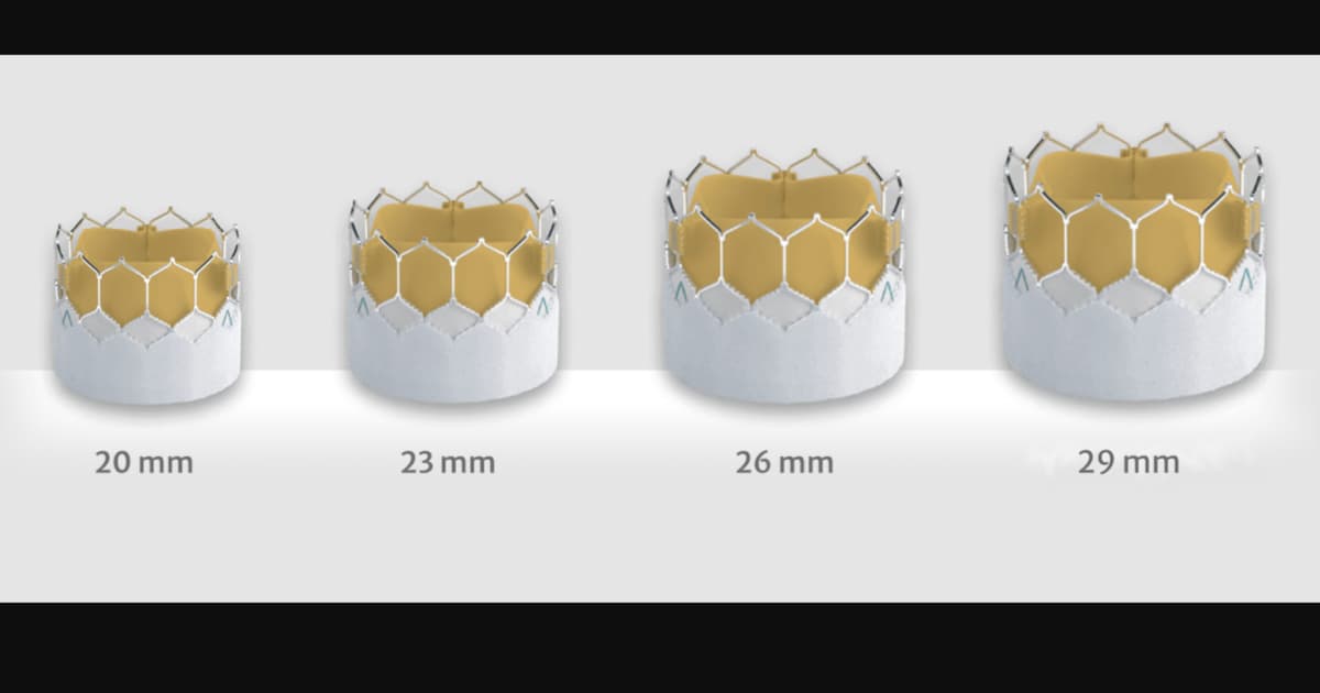 Redo TAVR with Balloon-Expandable Valves Linked to Positive Outcomes, Key Improvements