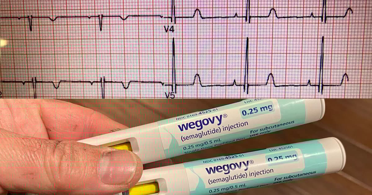 Multiple GLP-1 Drugs Linked to Lower AFib Risk