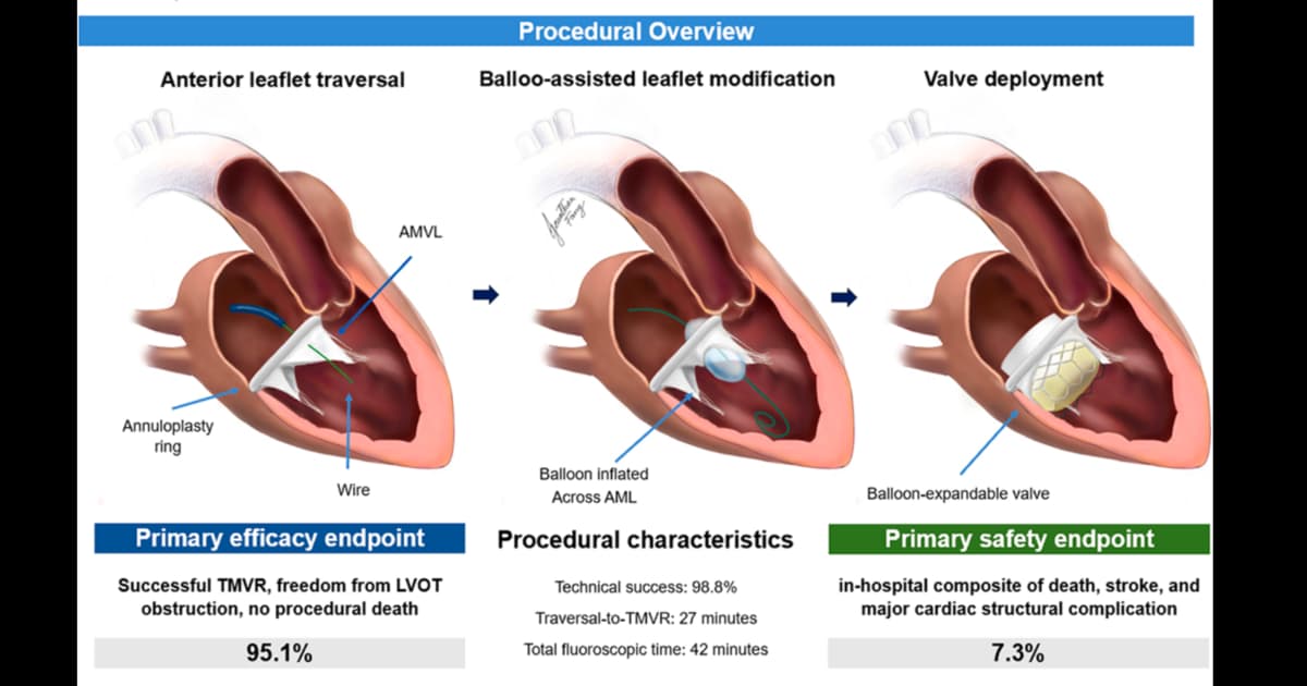 BATMAN to the Rescue: TMVR Technique Helps Cardiologists Reduce Risk of LVOT Obstruction