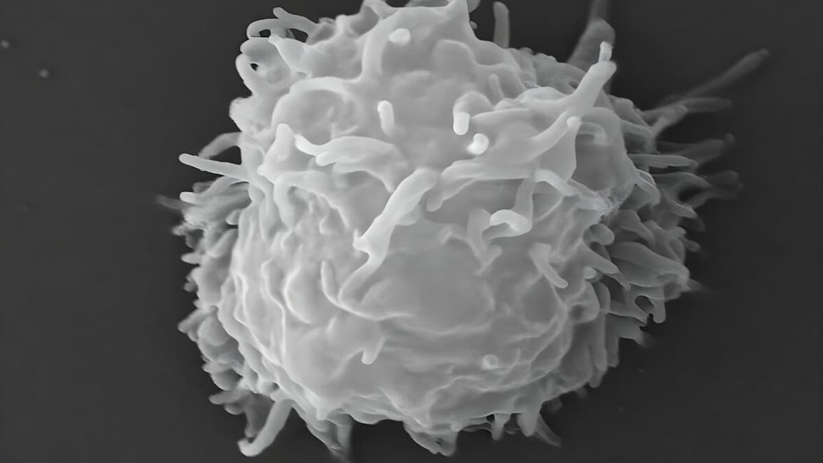 Man Dies Covered in Necrotic Lesions After Amoebas Eat Him Alive