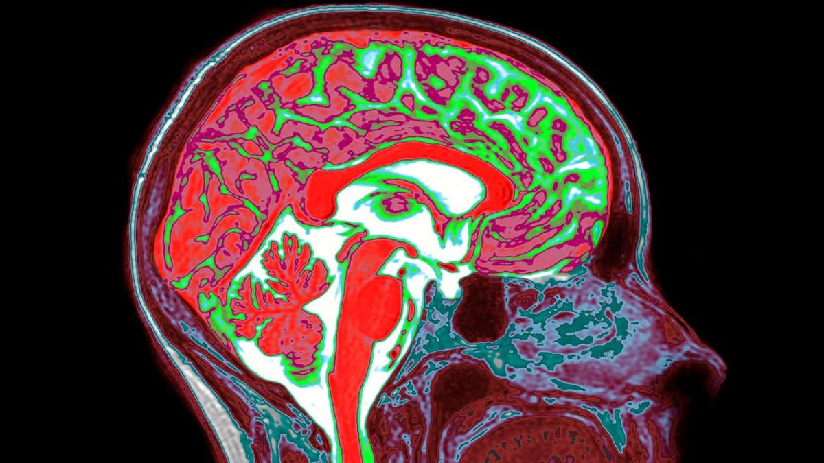 Estrogen in Both the Male and Female Brain Shapes Responses to Trauma, Study Suggests