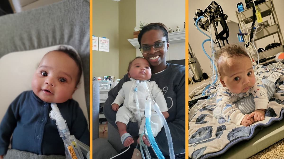 'Two Lives Hang in the Balance': Risky Surgery in the Womb Saved Baby From Deadly Disorder at Just 25 Weeks...