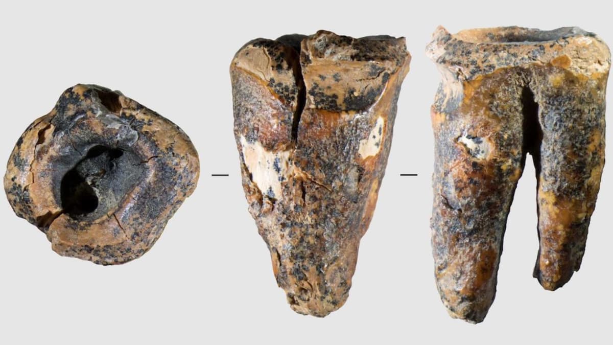 'Exceptional' Drilled Tooth Reveals Neanderthals Practiced Dentistry in Siberia 60,000 Years Ago
