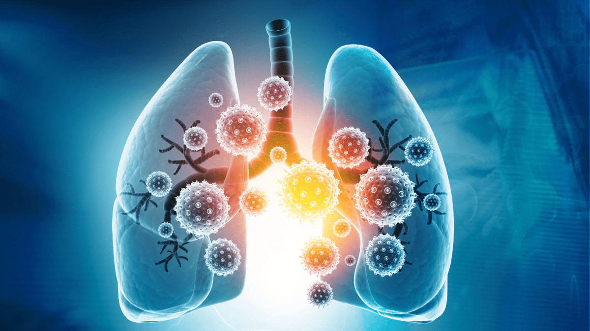FDA Approves Breztri for Patients 12 Years and Older with Asthma