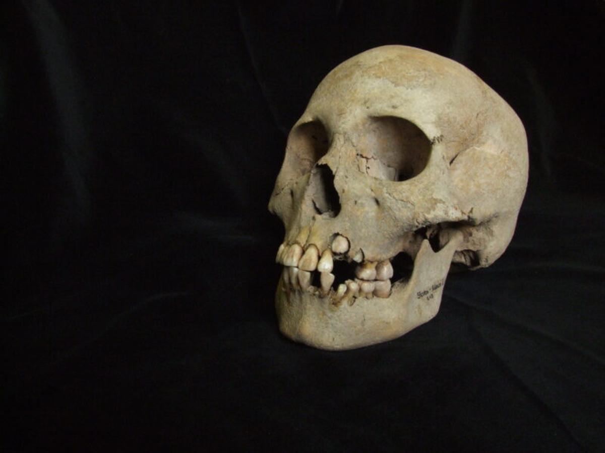 Ancient DNA Offers Clues to One of History’s Deadliest Diseases