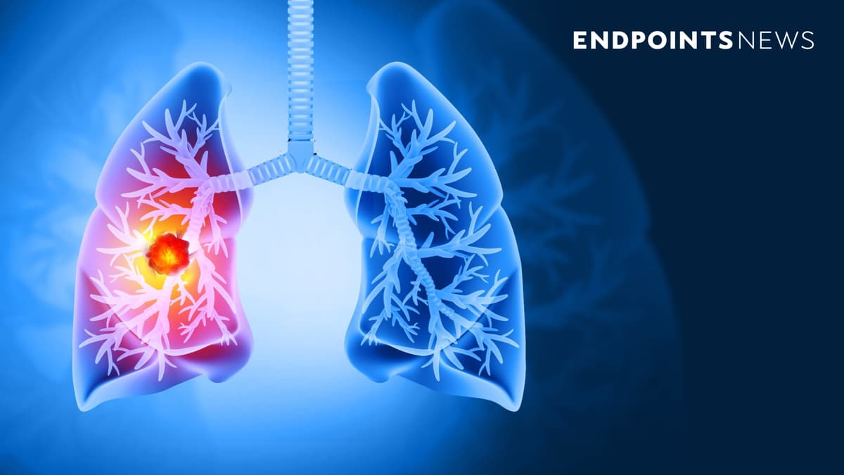 #ASCO26: Merck Partner Kelun Outlines Phase 3 Lung Cancer Success in China Study