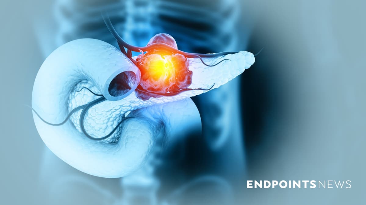 'It's Just the Beginning' For Pancreatic Cancer's Long-Awaited Breakthrough