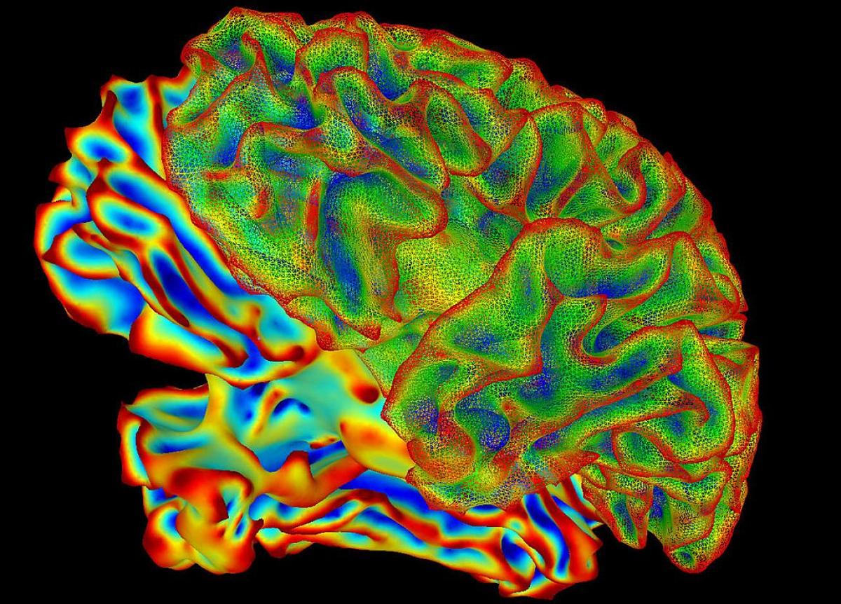 HMNC Brain Health Raises $50M Series B Led by MEDICE