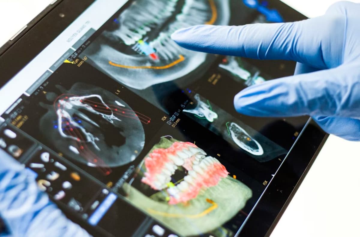 How Digital Smile Design Is Changing the Veneer Experience