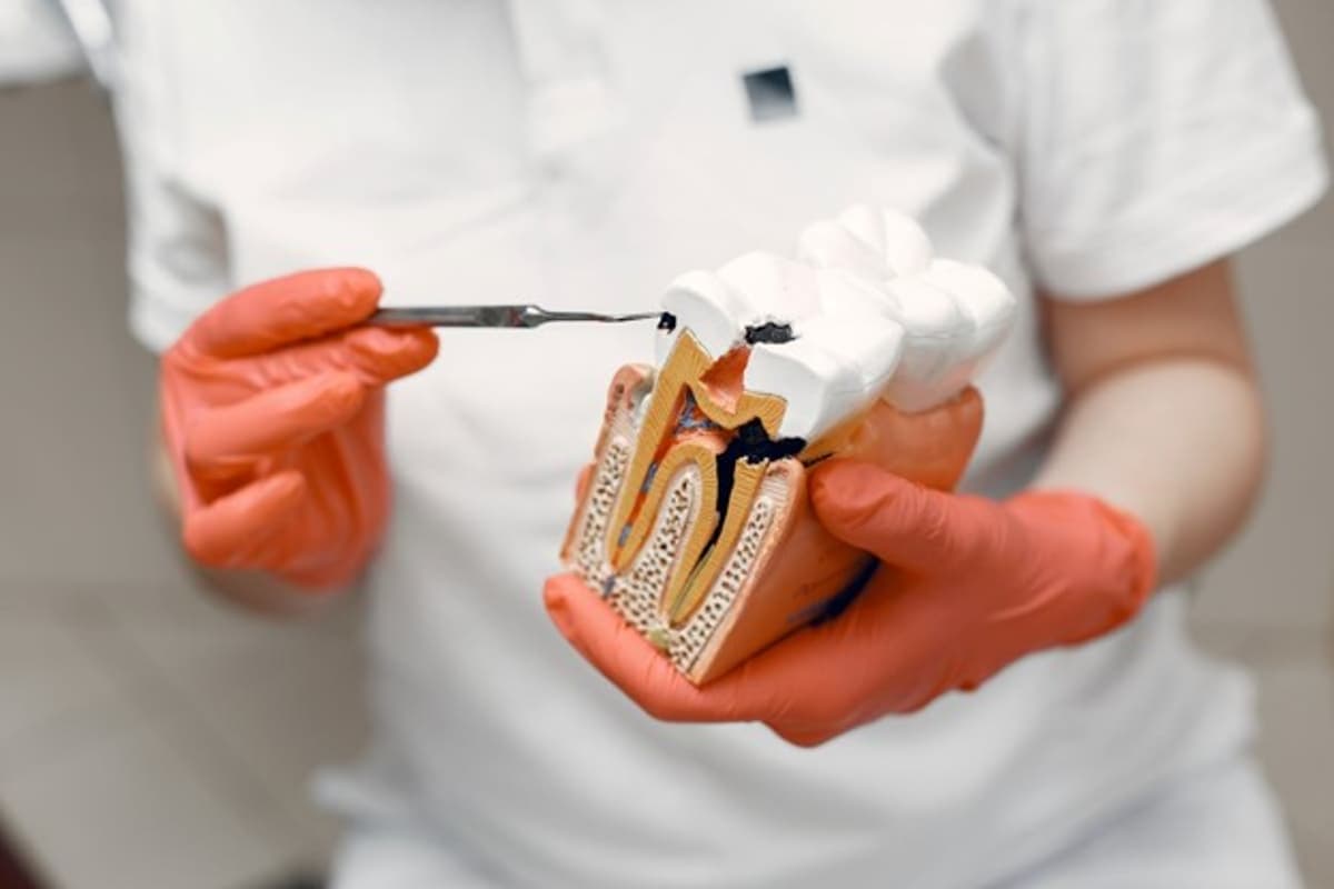 How to Speed Up Your Root Canal Recovery