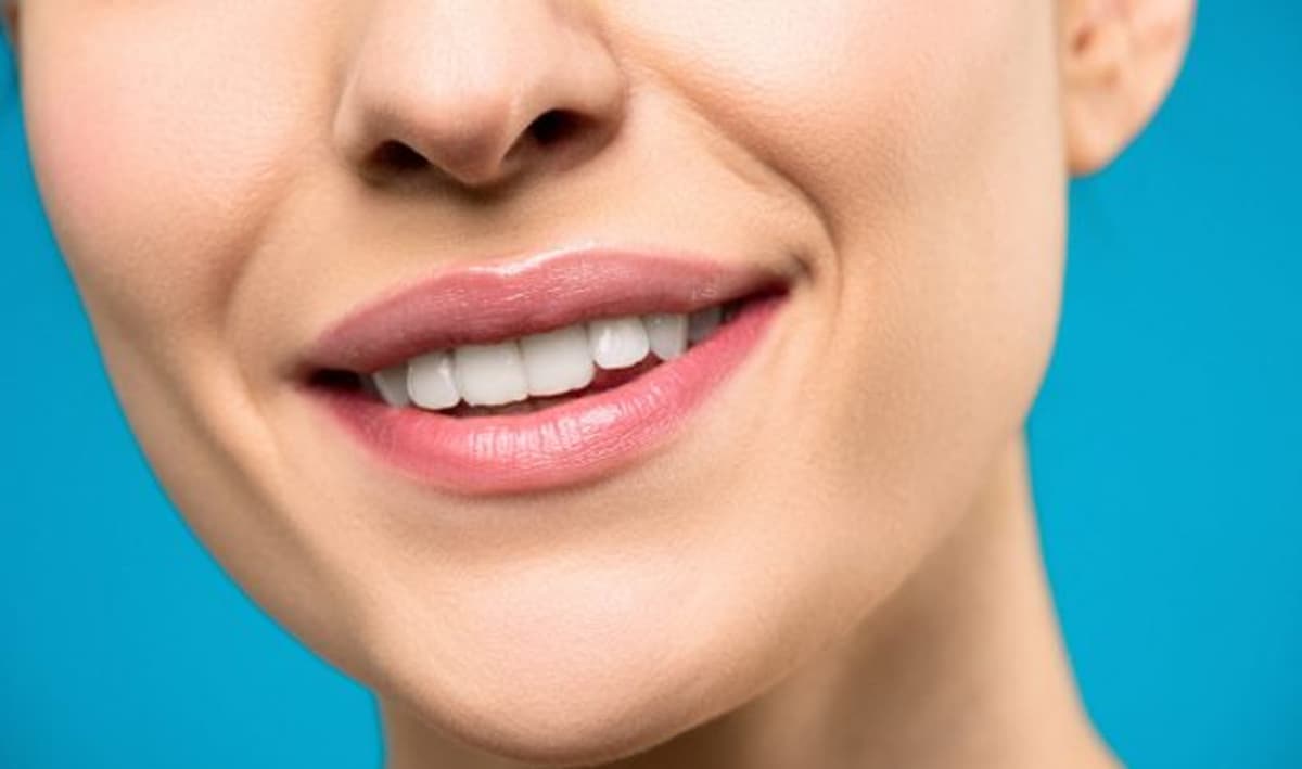 How Smile Makeovers Are Transforming Smiles in Marble Hill