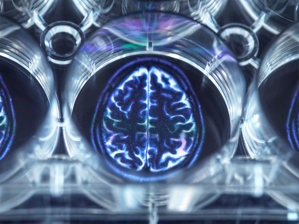 Scientists Are Trying to Train Lab-Grown Brains. The Brains Have Started to Solve Problems.