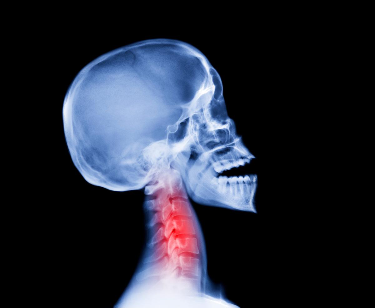 A Scientific Breakthrough Has Unveiled the Ancient Source of Our Pain