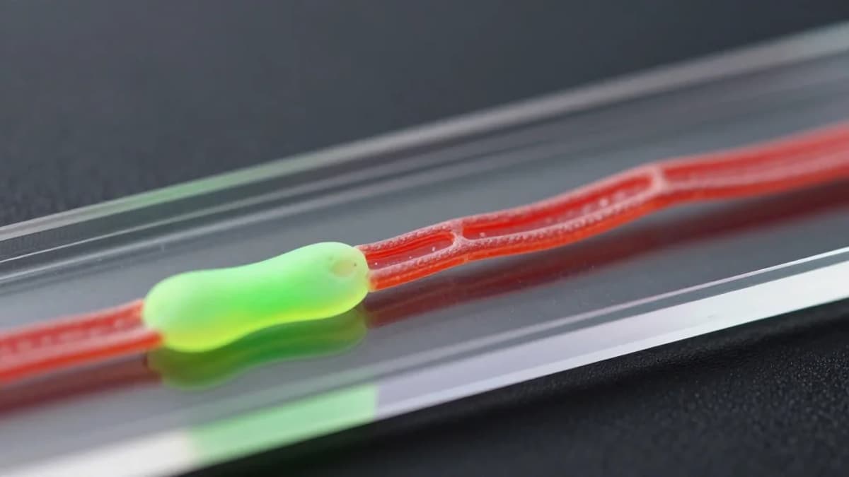 Biogen Phase Ib Data Positions Salanersen for SMA Treatment Sequencing