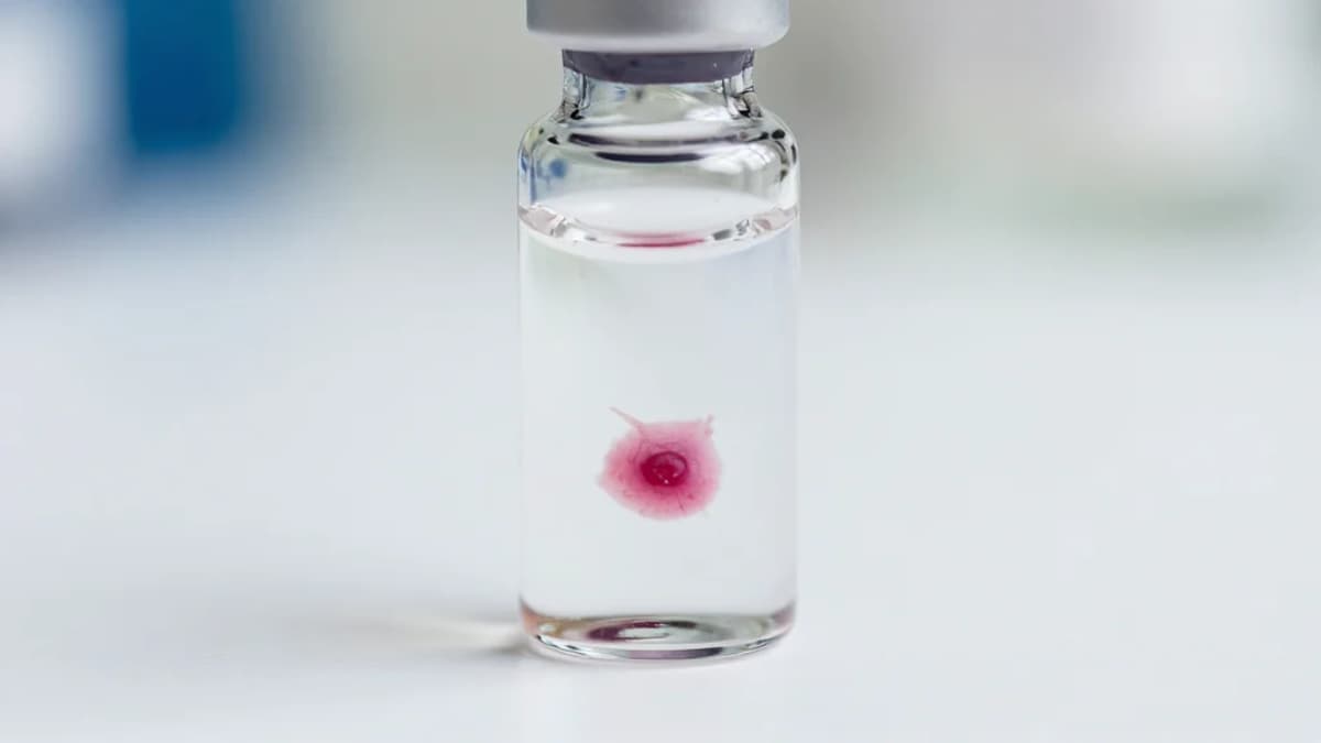 Strategic Intelligence Report on Bladder Cancer