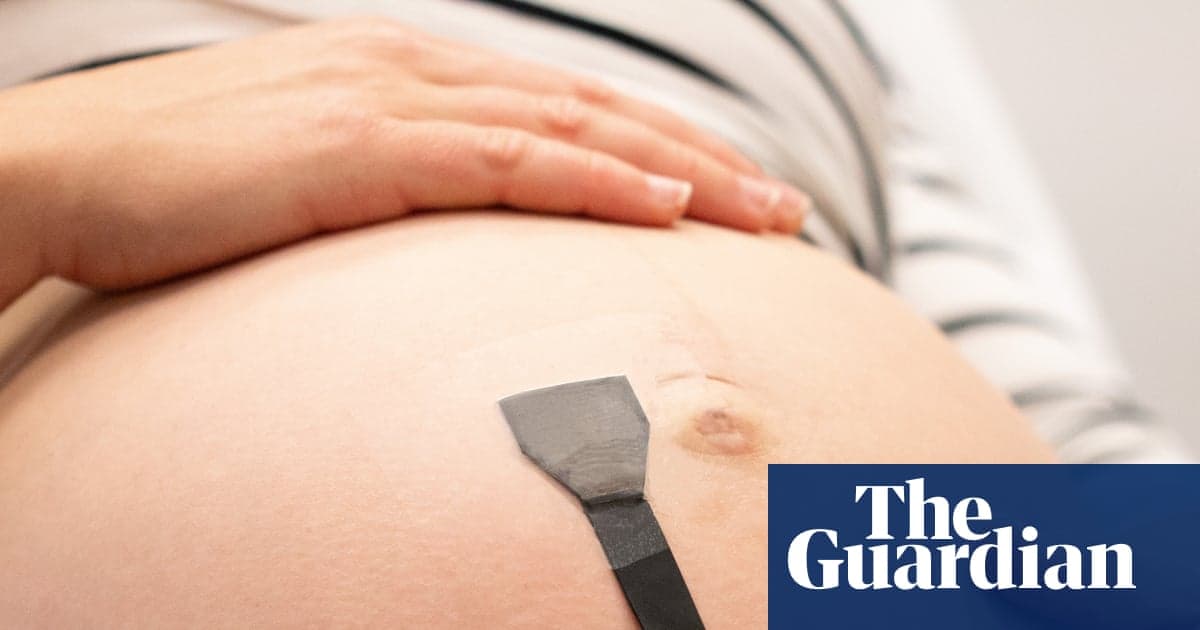 Scientists Create Wearable Ultrasound to Continuously Monitor Babies in Womb