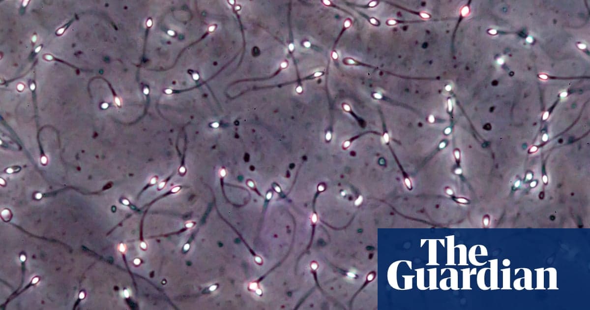 Man Produces Sperm From Testicular Tissue Frozen as a Child in Breakthrough Trial