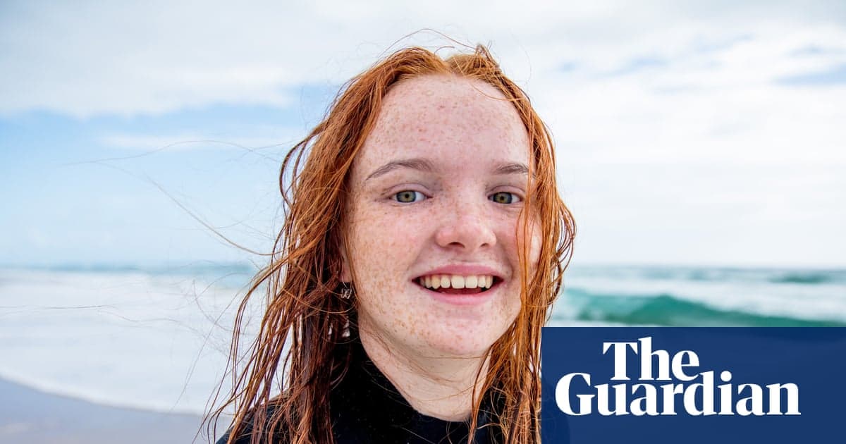 Red Hair Gene Favoured by Natural Selection over Last 10,000 Years, Study Finds