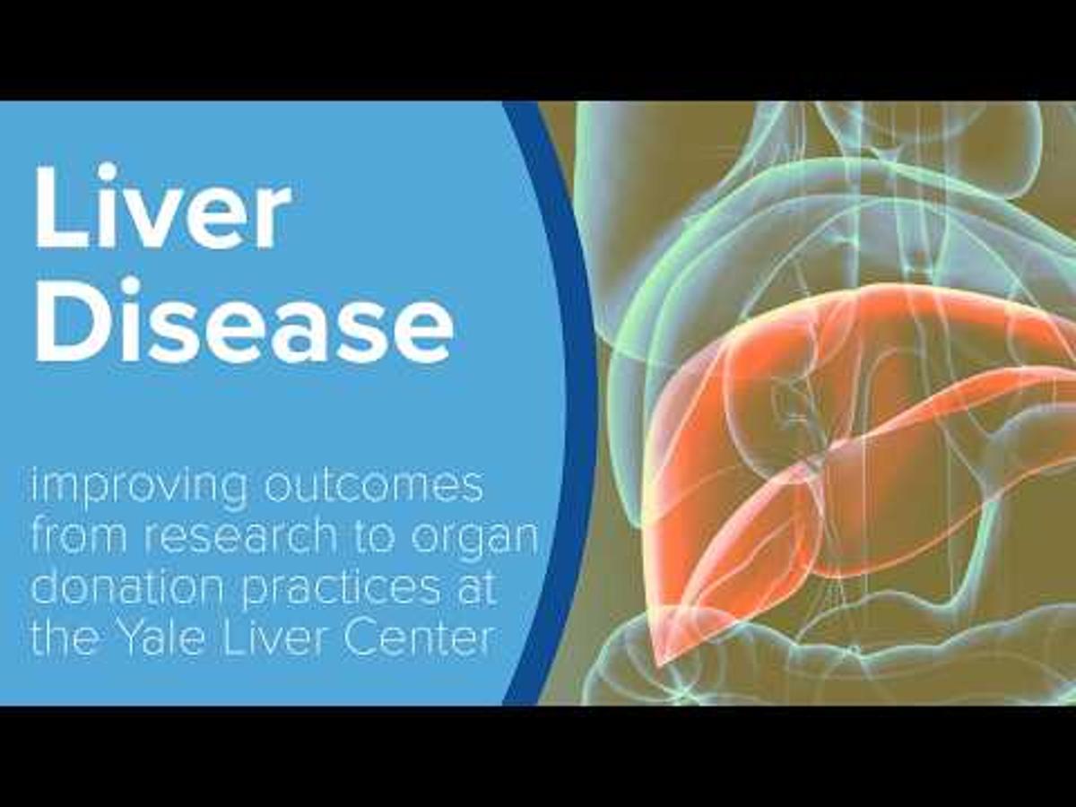 Chronic Liver Disease - Yale Medicine Explains