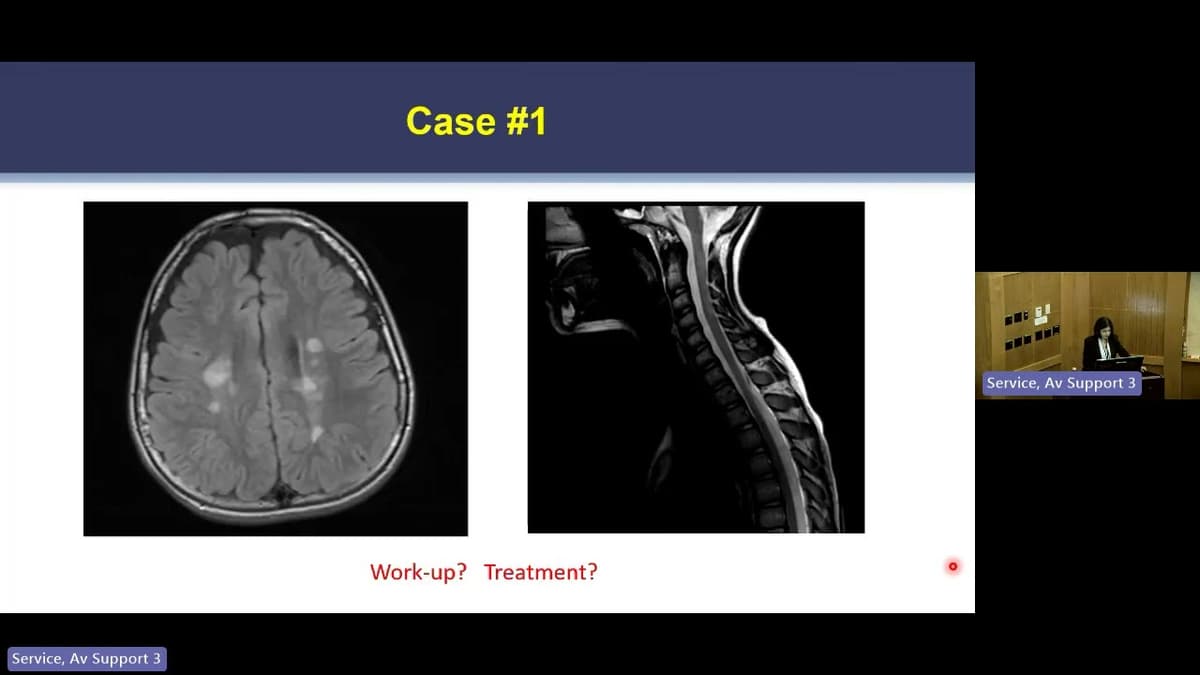 Wednesday, February 18, 2026 Does Multiple Sclerosis Start in Childhood? Tanuja Chitnis, MD