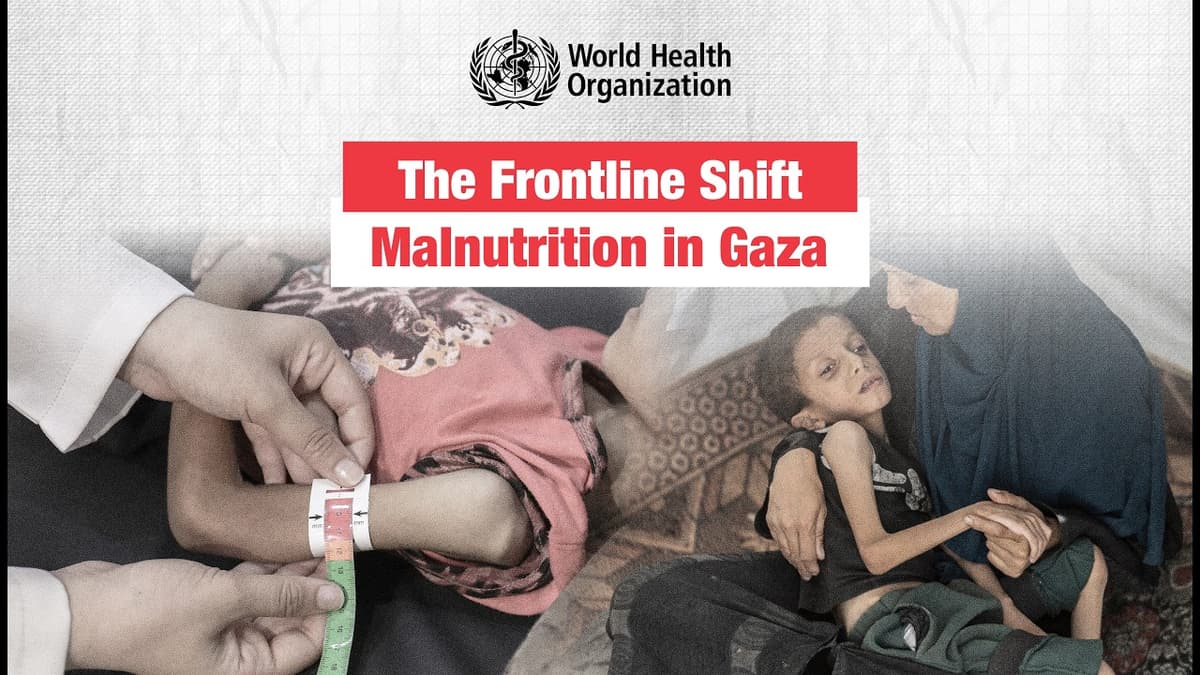 Malnutrition in Gaza