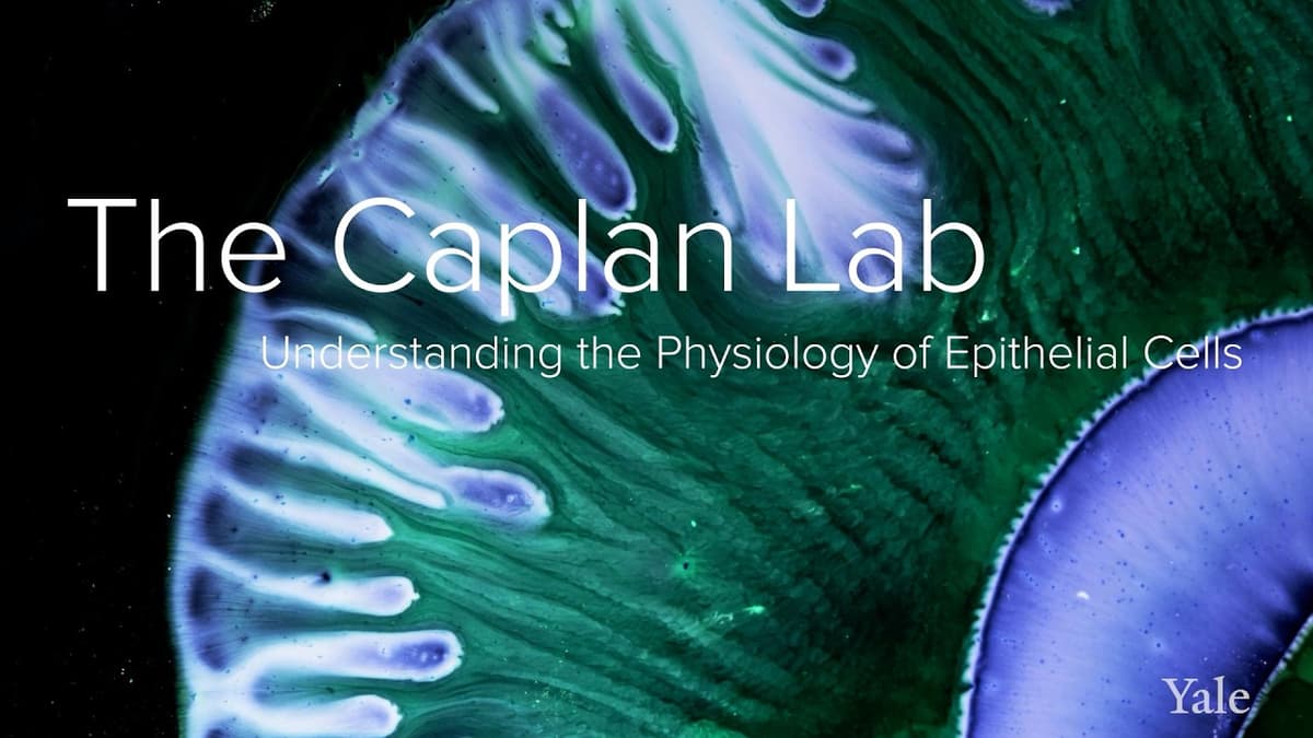 Cellular Trafficking & Polycystic Kidney Disease - The Caplan Lab at Yale School of Medicine