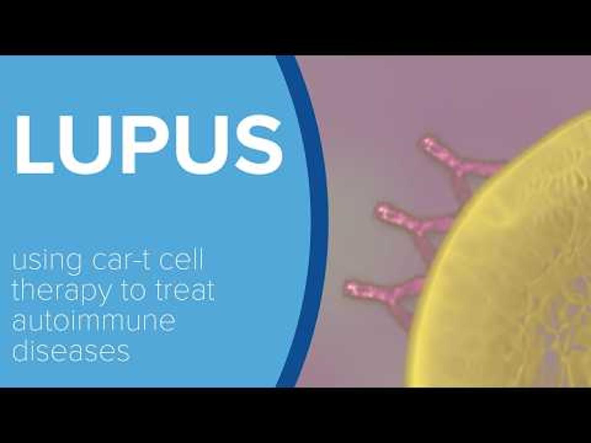 Treating Lupus with CAR-T Cell Therapy - Yale Medicine Explains
