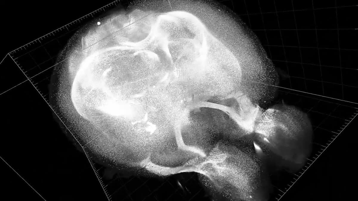 Millions of Oligodendrocytes Mapped in the Mouse Brain over Its Lifespan