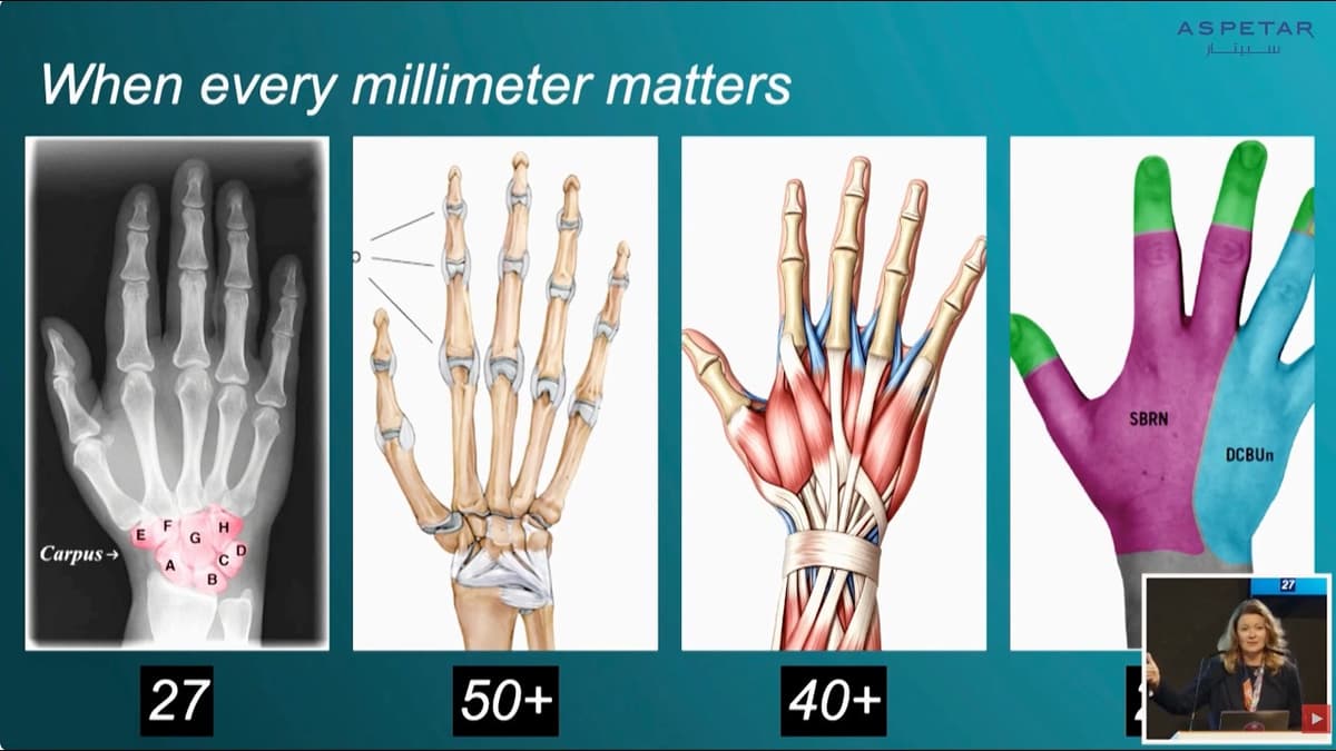 Surgical Perspectives on Athlete’s Hand and Wrist Injuries When Every Millimeter Matters