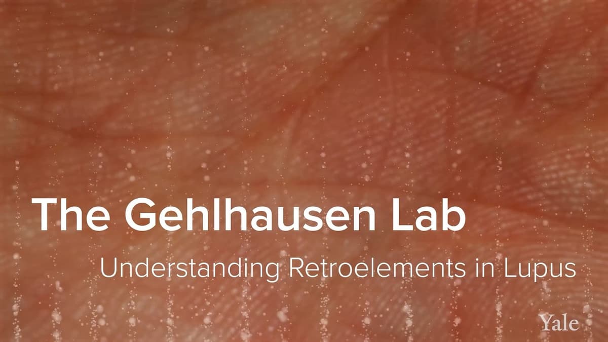 Lupus, Autoimmune Inflamation & Retroelements - The Gehlhausen Lab at Yale School of Medicine