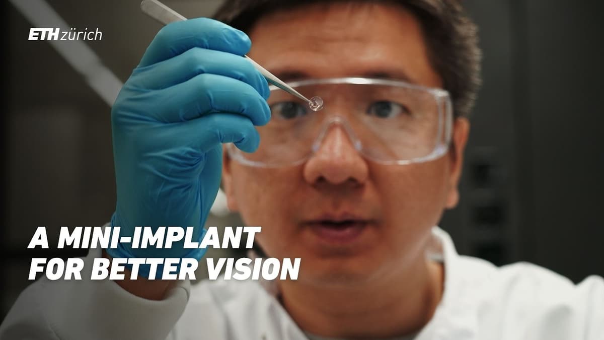 A New Treatment for Keratoconus: Lab-Made Hydrogel Implant Could Restore Vision