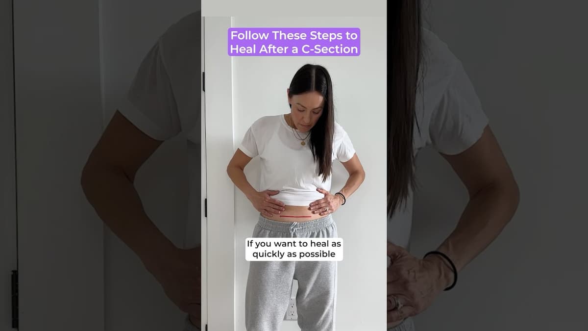 Follow These Steps to Heal After a C-Section