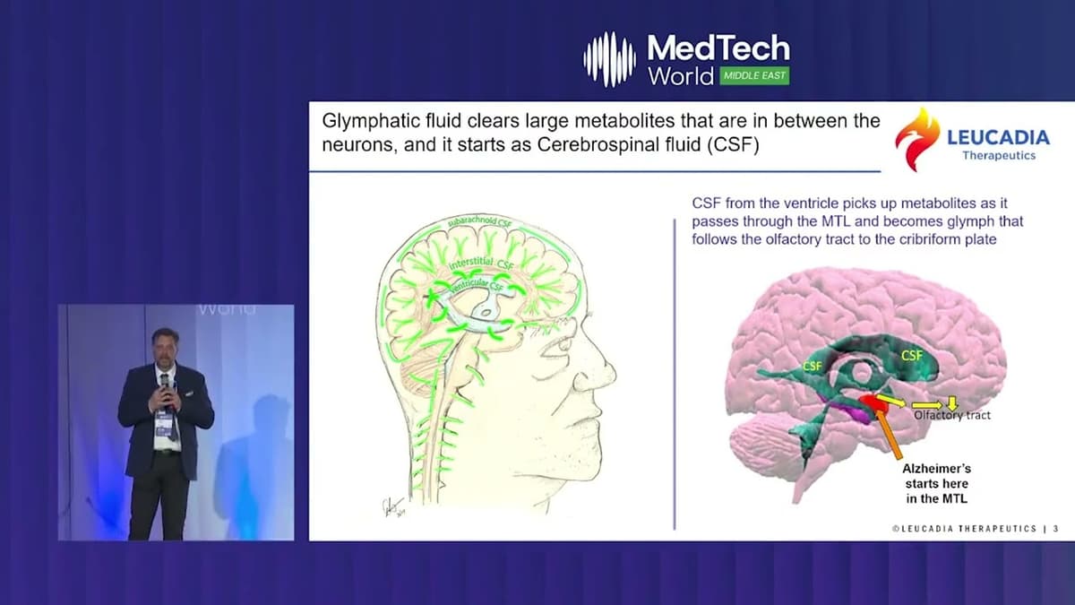 A New Approach to Alzheimer’s? Leucadia Therapeutics | MedTech World Middle East 2026