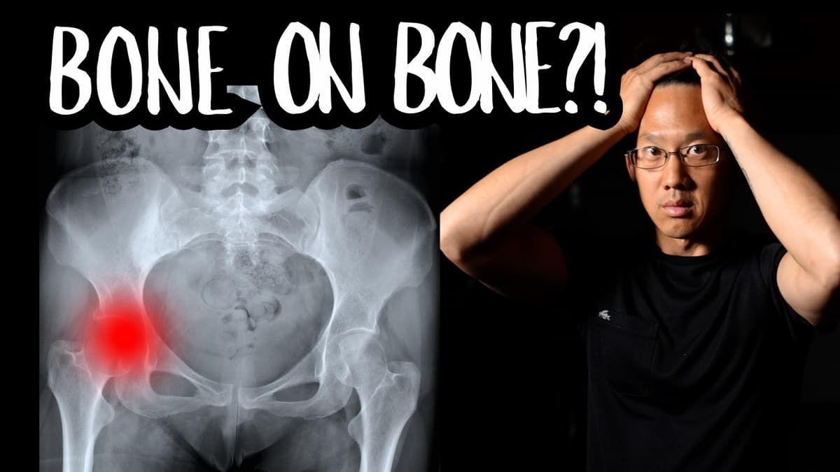 Your Hip X-Ray May NOT Explain Your Pain