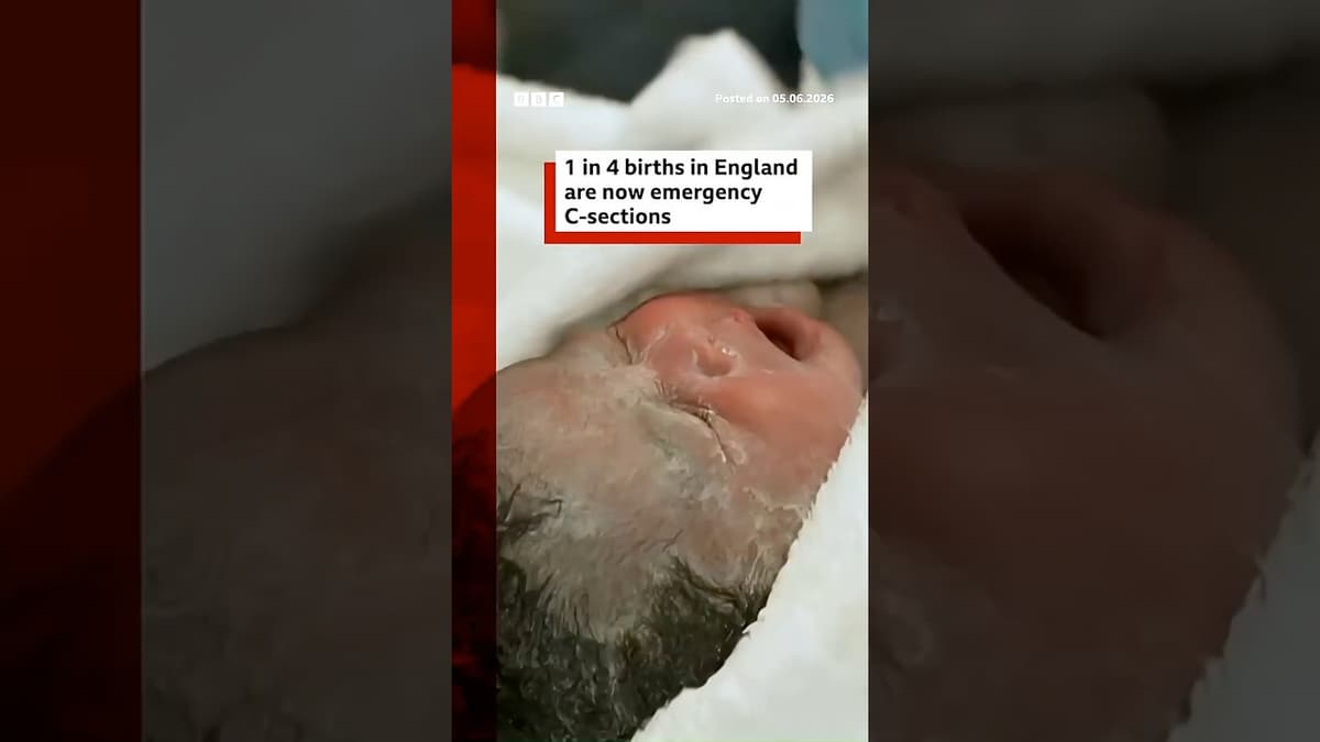 One in Four Births in England Are Now Emergency Caesareans, BBC Analysis Shows. #BBCNews