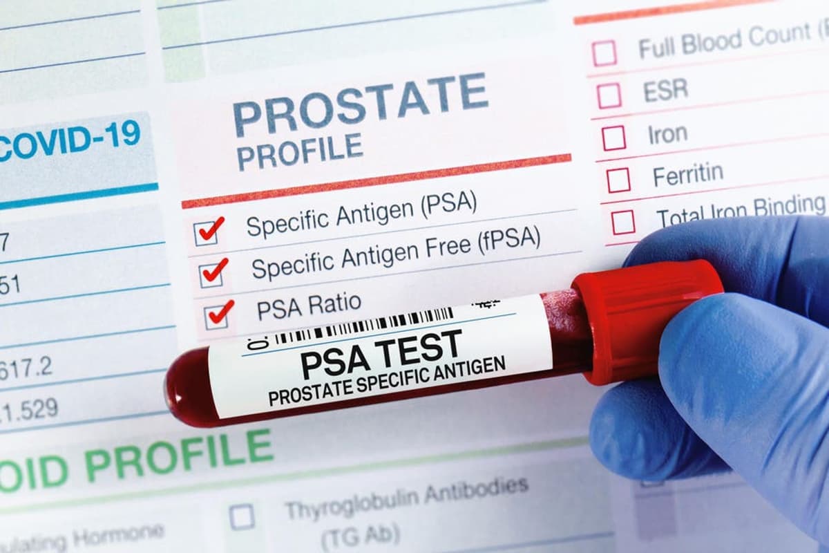 Weighing Pros And Cons Of Prostate Cancer Blood Tests