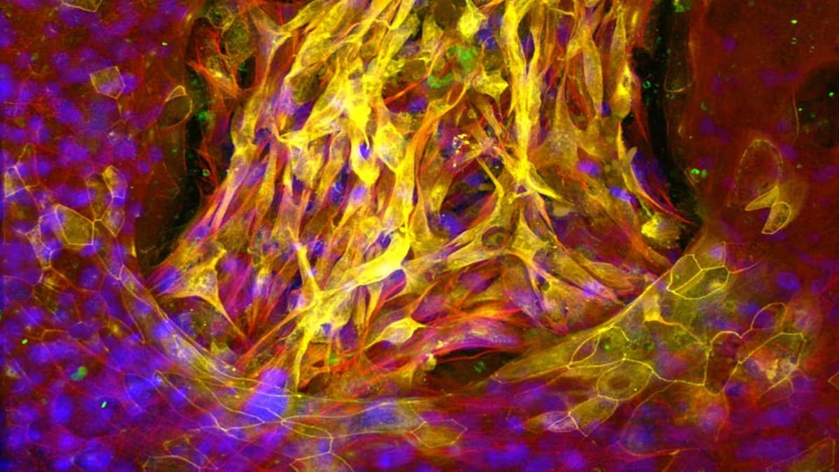 Human Organ Chip Systems Reshape Drug Development